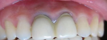 1439255829954108.png 图片4.png