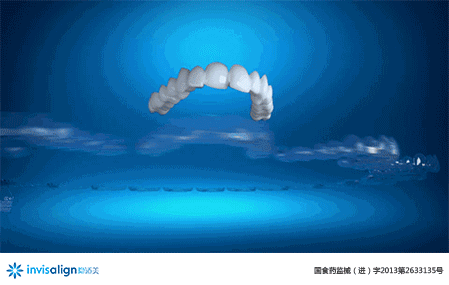 1471327862831653.gif 隐适美牙套矫正过程模拟.gif