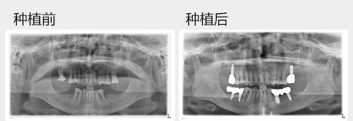 1472005276399643.jpg 案例图模板.jpg