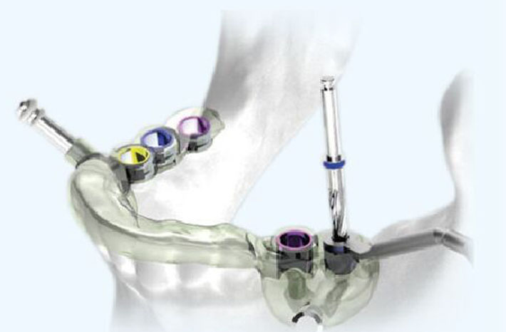 1497949045570864.jpg 222.jpg