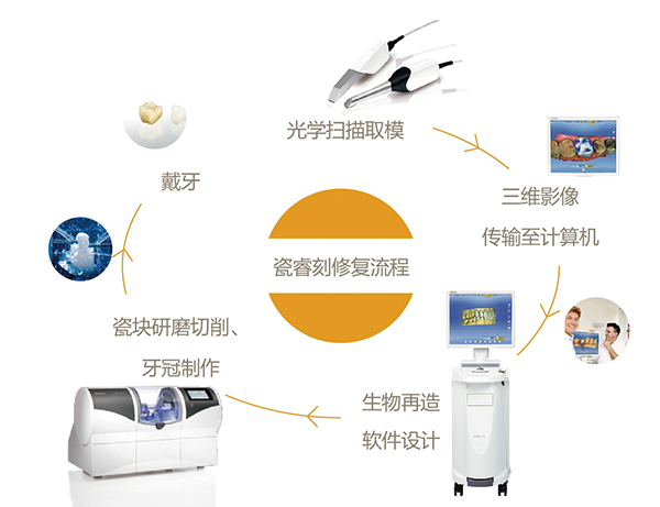 1459905489393046.jpg 瓷睿刻系统.jpg