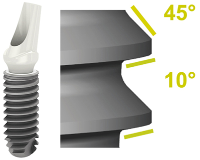 种植体示意图-苏州美奥口腔 种植体示意图-苏州美奥口腔