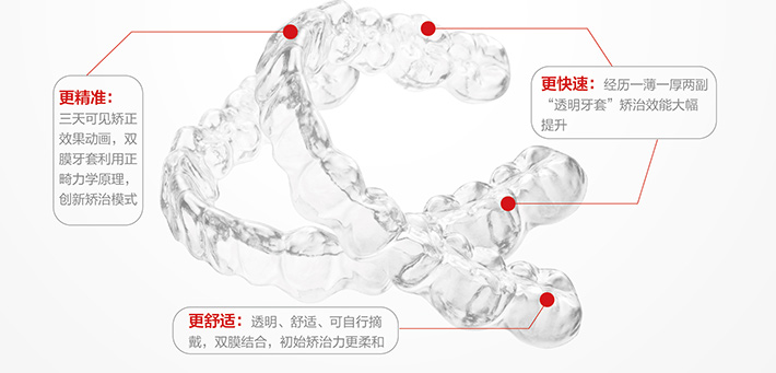 美奥口腔隐形矫正活动报道 美奥口腔隐形矫正活动报道